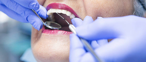 Best Emergency Root Canal Treatment in Mcadoo, PA